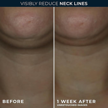 RoC Derm Correxion Neck Cream with Hyaluronic Acid and Advanced Retinol to visibly Tighten & Lift Horizontal Neck Lines, Facial Moisturiser to Contour Face, Neck + Jaw, (1.7 oz) with Retinol Packette