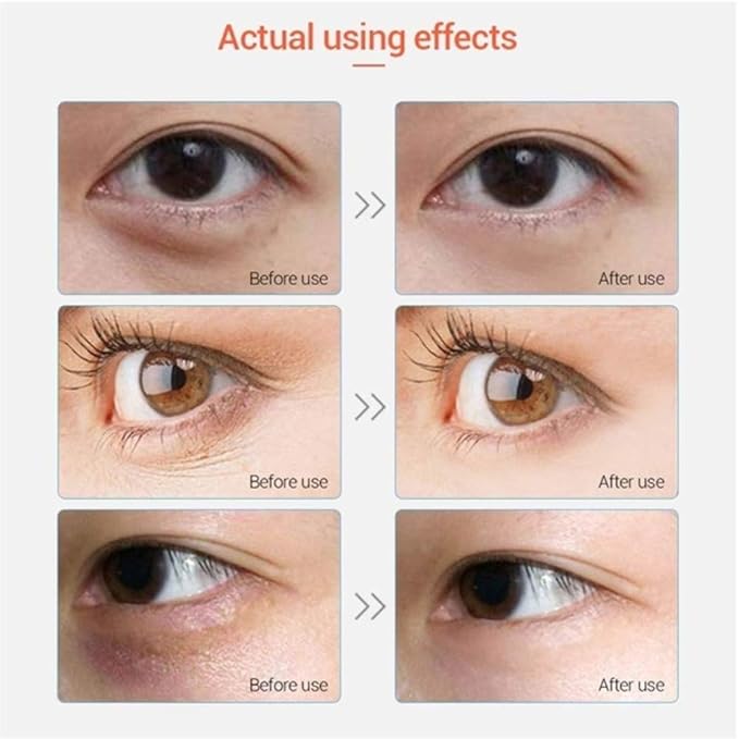 Adofect 30 pairs pink eye