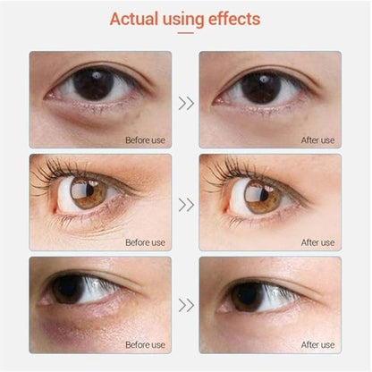 Adofect 30 pairs pink eye