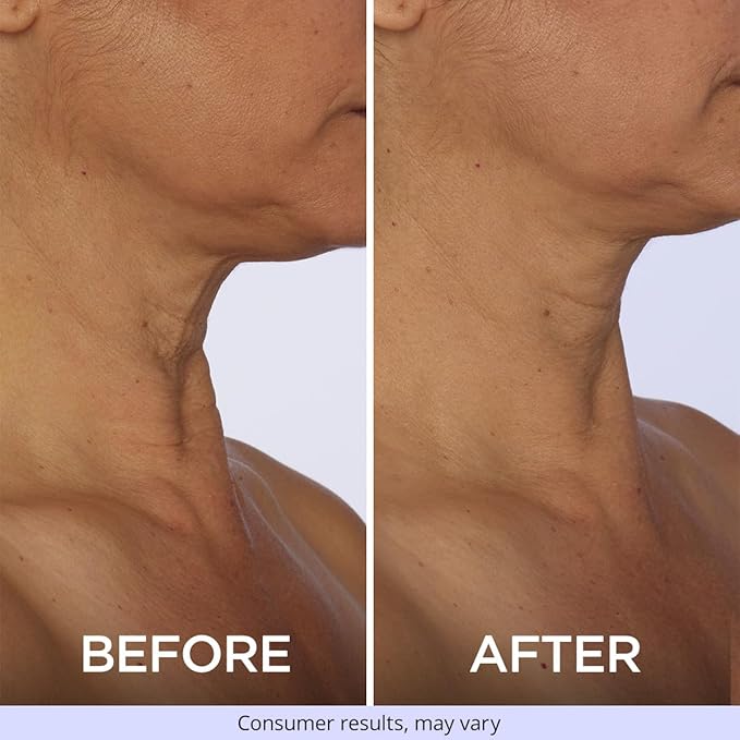 goPure Tighten and Lift Neck Cream - Clinically Tested - Pack of 2
