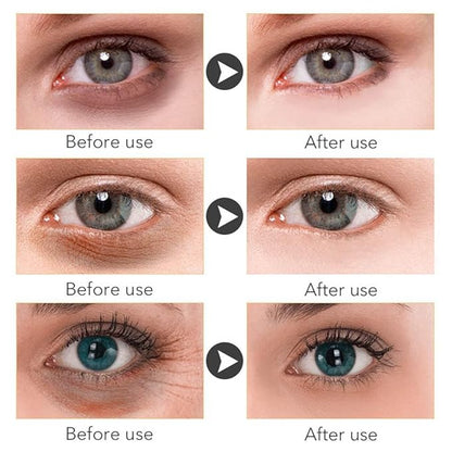 Magic retinol eye cream for