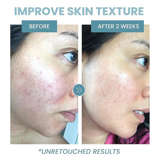 Collagen Peptide Serum - Anti Aging Collagen Serum for Face, Skin Brightening, Reduces Fine Lines & Wrinkles (1 oz)