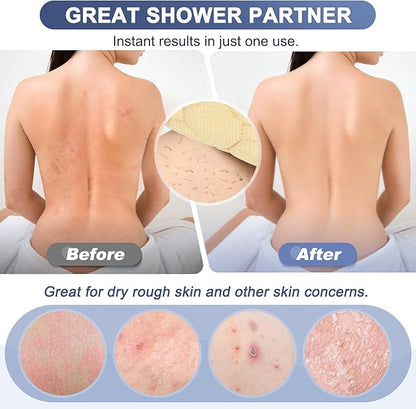 Exfoliating back scrubber with handles,