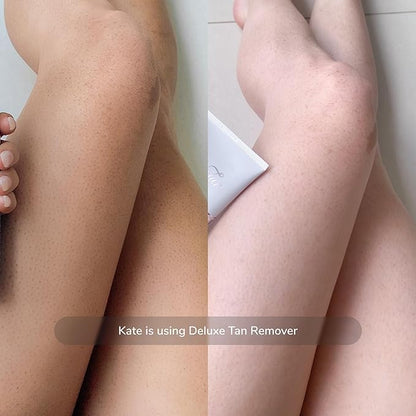 Loving Tan Deluxe Tan Remover Gel - Effective & Gentle Self Tanning Remover, Self Tanner Remover Suited for All Skin Types - Cruelty Free, Sulphate, Paraben & PEG Free - 6.7 Fl Oz