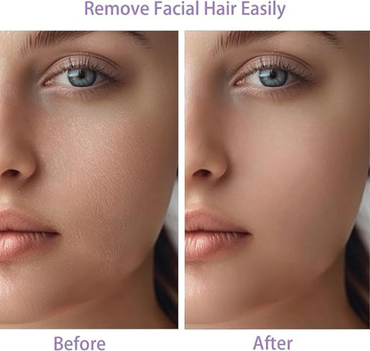 Women Facial Hair Removal Device Battery Operated with 2 Replacement Heads, Painless Womens Face Shaver for Chin Upper Lips Peach Fuzz