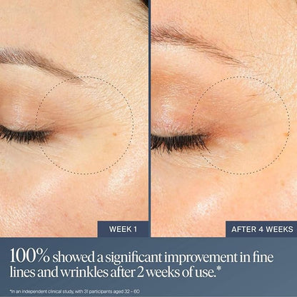 Summer Fridays Jet Lag Overnight Eye Serum - Nourishing Undereye Treatment for Dark Circles - Helps to Hydrate, Smooth, Firm & Depuff - Enriched with Glycerin to Lock in Moisture (0.5 Fl Oz)
