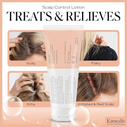 KAMEDIS Moisturizer Leave-On Botanical Scalp Lotion. For Dandruff, Dry, Itchy, Flaky and Sensitive Scalp Skin. Over-Night Head Mask, Parabens Free. 3.38 Fl Oz. (Scalp Lotion (2pk))