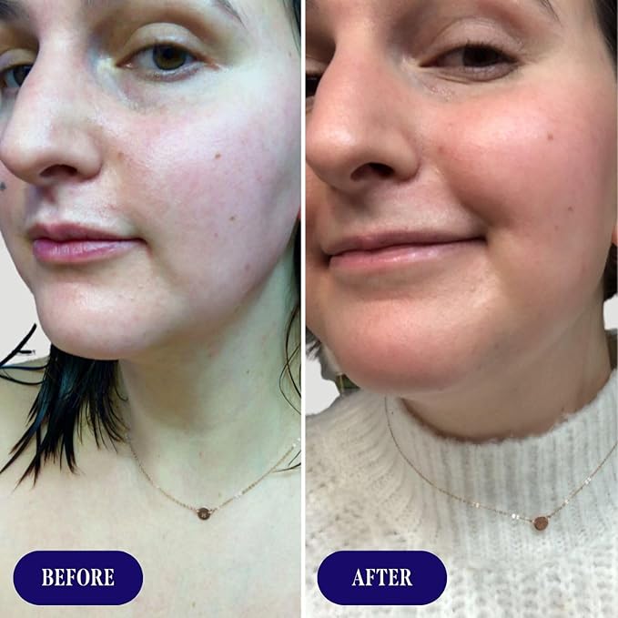 Three Ships Boost 49% Rosehip Oil Serum- Firming Face Serum, Smooths, Hydrates + Protects Skin, Plumps Look of Fine Lines and Reduces Discoloration (1 floz)
