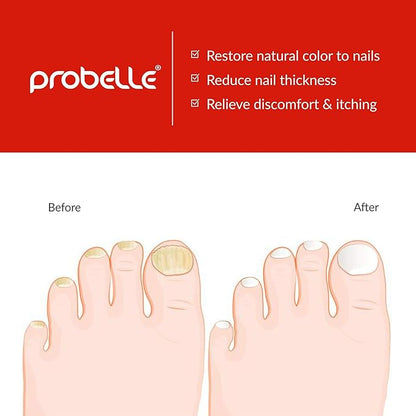 Probelle Natural Fungal Nail Oil,