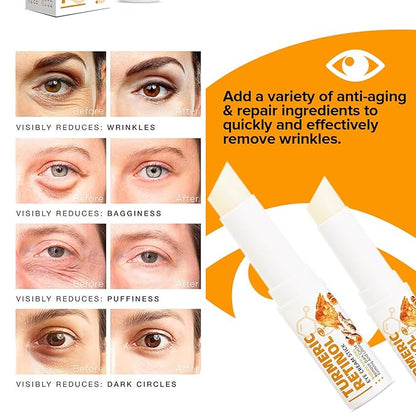 Turmeric retinol eye stick,eye balm
