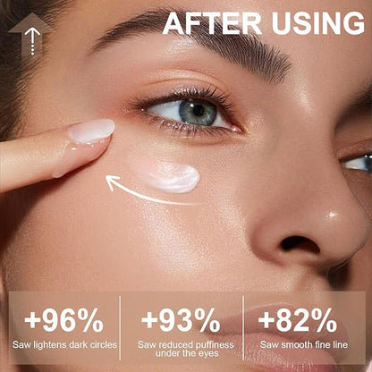 Caffeine Eye Cream for Dark Circles Under Treatment Eye Serum for Wrinkles Fine Lines, Retinol Under Cream for Puffiness and Bags with 360° Massage Roller-Ball