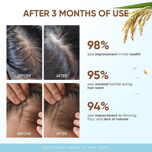 Rice Water Hair Growth Shampoo - Biotin Thickening Shampoo for Hair Loss and Thinning - Sulfate Free for Women and Men 10 Fl Oz (Pack of 1)