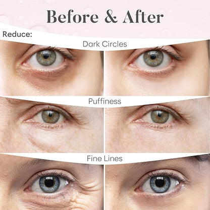 Rose eye mask (30 pairs)