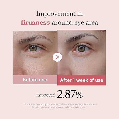 medicube Salmon DNA PDRN Pink Peptide Eye Serum with Niacinamide and 99% Purity Retinol for Fine Lines, Uneven Skin Tone, Korean Skin Care 1.01fl.oz