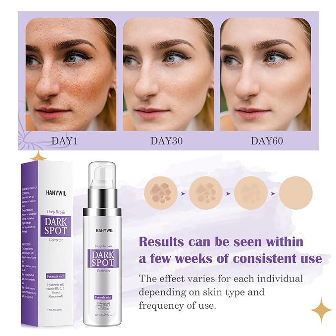 Dark Spot Corrector for Face & Body,Rapid Tone Repair Cream with Hyperpigmentation Treatment,Sun Spot, Age Spot & Melasma Remover,Dermatologist-Tested Brightening Retinol Serum (1.7 Fl Oz)