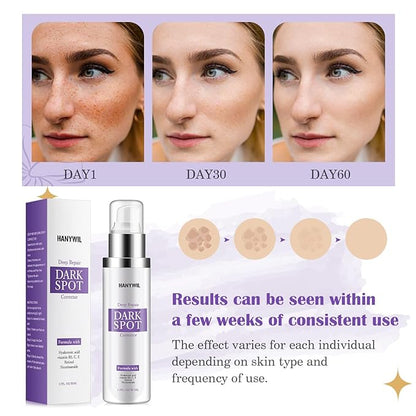 Dark Spot Corrector for Face & Body,Rapid Tone Repair Cream with Hyperpigmentation Treatment,Sun Spot, Age Spot & Melasma Remover,Dermatologist-Tested Brightening Retinol Serum (1.7 Fl Oz)