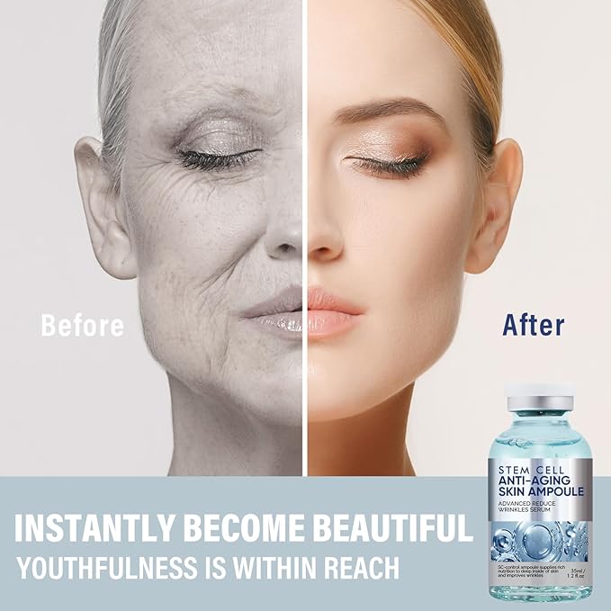 Stem Cell Serum for Face, Microneedling Serum, Stem Cell Solution Ampoule to Use with and without Micro Needling, Anti Aging & Smooth Wrinkles, 1.2 OZ