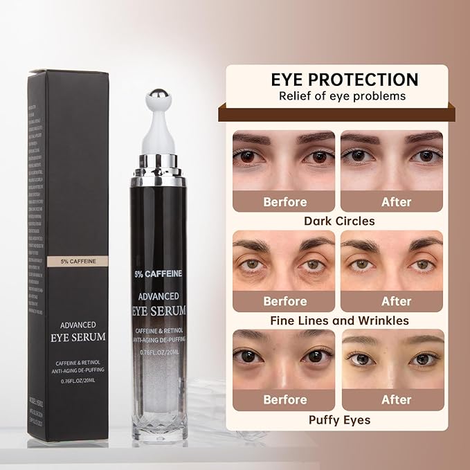 Caffeine 5% eye cream for
