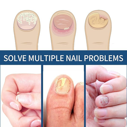 Nail Repair Patches 64 PCS,Nail
