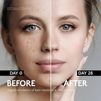 EnaSkin Dark Spot Remover Face & Body Serum: Age Spot Sun Spot Freckles Melasma Brown Spot - Advanced Formula with Niacinamide for Women and Men (1.0 Fl Oz)