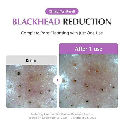 Purple Rice Pore Purifying Pack Cleanser - Dual-Use Clay Mask & Foam Cleanser | Deep Cleansing for Pore Care & Skin Prep | AHA+BHA+PHA | Korean Skincare for Glass Skin, 4.58 OZ. (130g)