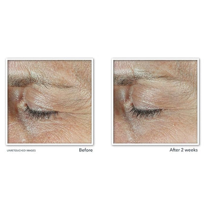 Roc derm correxion dual eye