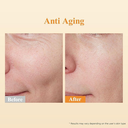HKH Retinol + HPR Serum for Face - Anti-Aging Wrinkle Night Retinol Capsules, Peptide Serum for Women, Reduce Fine Lines, Tighten Sagging Skin, Fragrance-Free, Alcohol-Free & Non-Greas