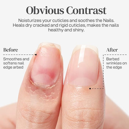 Nail Cuticle Oil for Nails