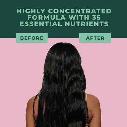 SHAZ & KIKS Essential Prewash Mask for Fine, Thin to Medium Hair | Scalp & Hair Mask Delivering 35+ Essential Nutrients to Build Long-term Health | Stimulate Growth & Thicken Fine Strands, 7.7 oz