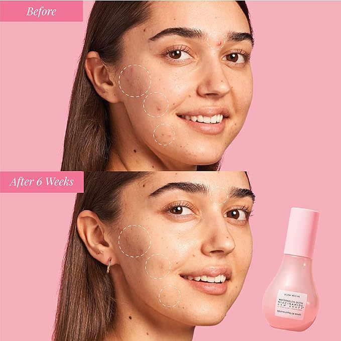 Glow Recipe Watermelon Niacinamide Dew Drops - Brightening, Plumping Hydrating Face Serum, Makeup Primer + Liquid Highlighter with Hyaluronic Acid - Dewy & Glowing Korean Skin Care (80ml)