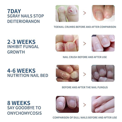 Nail Repair Patches 64 PCS,Nail