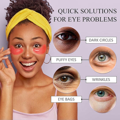 Shvyog under eye patches (20