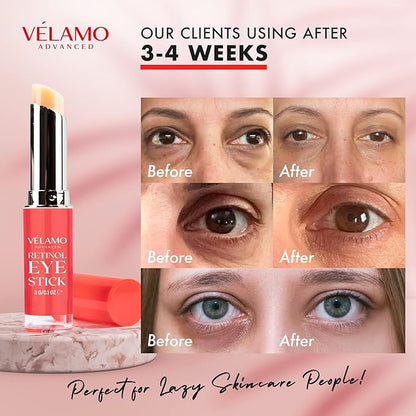 Retinol eye stick, retinol eye