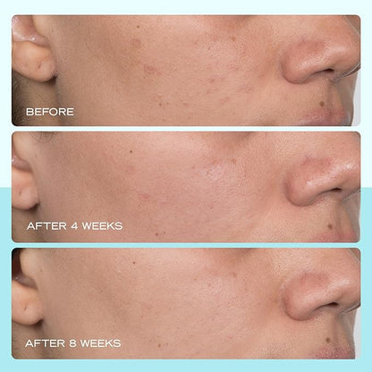 First Aid Beauty - Dark Spot Serum with Niacinamide, Helps Reduce Look of Dark Spots, Sun Spots, Hyperpigmentation, Discoloration & Post-acne marks, Non-Comedogenic, Safe for Sensitive Skin, 1 oz