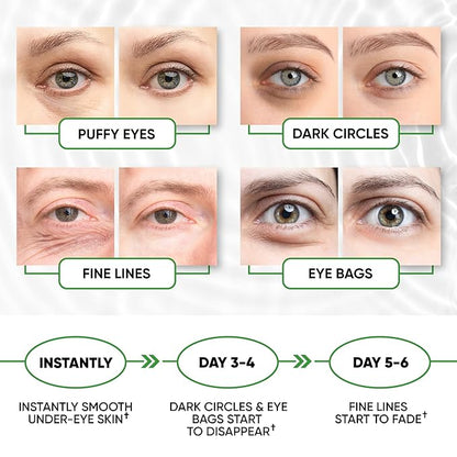 Under Eye Mask for Puffy