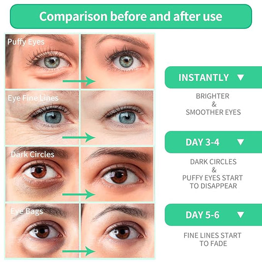 Breylee aloe vera eye masks