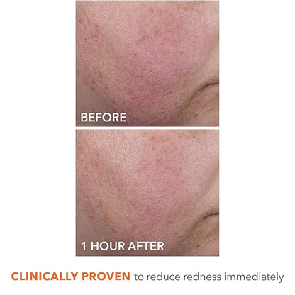Dr Dennis Gross DermInfusions Blur + Repair Cream, Instantly Blurs Fine Lines, Smooths Skin with Satin-Matte Finish, Visibly Plumps & Firms, Reduces Redness, and Improves Skin Elasticity, 1.7 Fl Oz