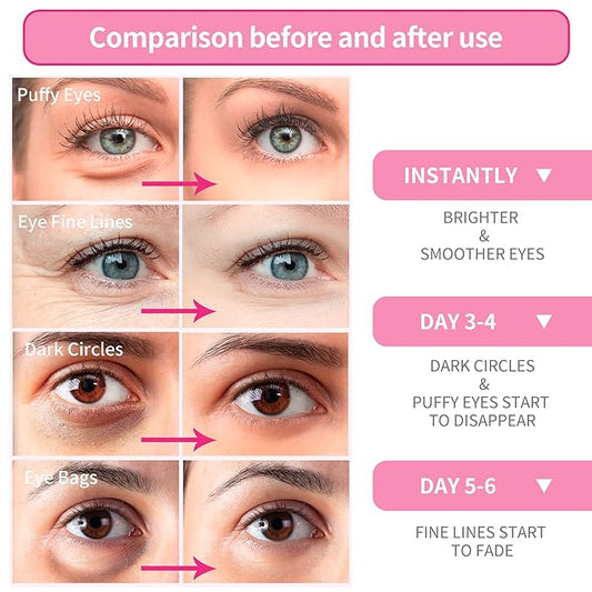 Breylee pink rose eye mask??30