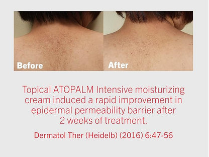 ATOPALM | Intensive Moisturizing Cream | Face & Body Moisturizer | For Dry & Sensitive Skin | Paraben-Free Lotion | Replenishes Hydration | Skin Barrier Repair | Korean Skin Care | 3.4 fl oz (100ml)