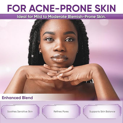 Azelaic Acid Acne Cream: Azelaic Acid For Face - Premium Azelaic Acid Cream - Face Skin and Beauty Care - Azelaic Acid Facial Cream, 1 Oz