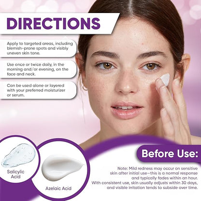 Azelaic Acid Acne Cream: Azelaic Acid For Face - Premium Azelaic Acid Cream - Face Skin and Beauty Care - Azelaic Acid Facial Cream, 1 Oz