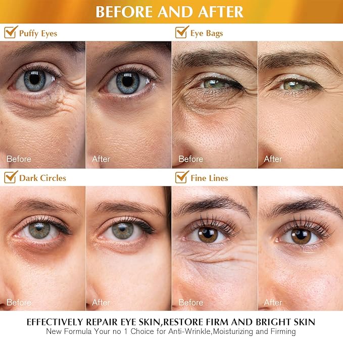 Enaskin naturals under eye patches