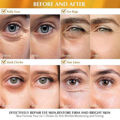 Enaskin naturals under eye patches