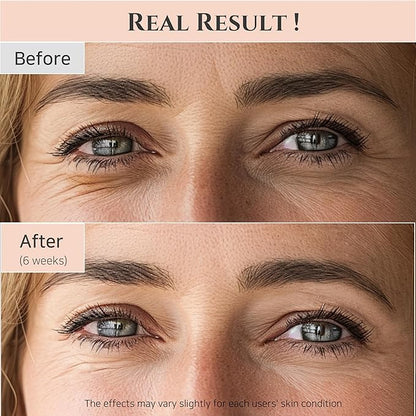 Beauty of Joseon Revive Eye Serum with Retinal Niacinamide Correction for Puffy Eye Bags Fine Lines Dark Circles Wrinkles, Korean Skin Care 30ml, 1 fl.oz, 2 Packs