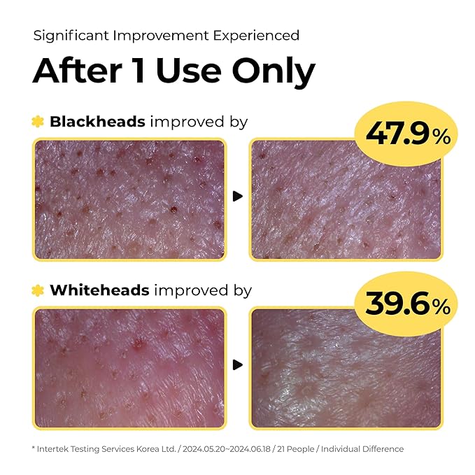 Sulfur Mineral Cleansing Powder, Exfoliating Facial Wash with Enzymes and PHA for pores and blackheads, Even Skin Tone, Radiant, Sensitive, Acne-Prone Skin, Korean Skincare(1.76 oz. 50g)