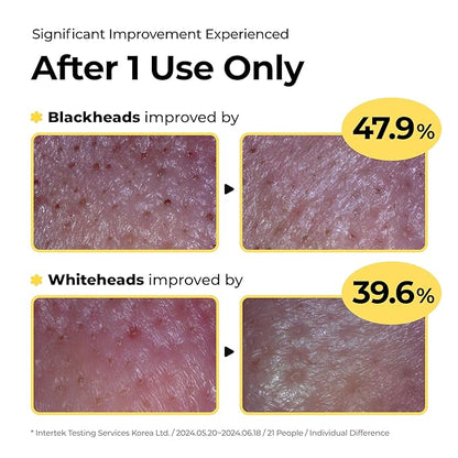 Sulfur Mineral Cleansing Powder, Exfoliating Facial Wash with Enzymes and PHA for pores and blackheads, Even Skin Tone, Radiant, Sensitive, Acne-Prone Skin, Korean Skincare(1.76 oz. 50g)